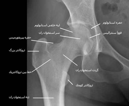1555 1